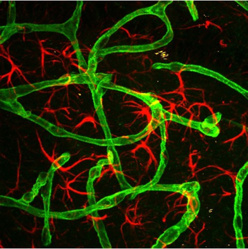 Two-photon mouse brain image from a cerebral malaria model with vessels in green and astrocytes in red