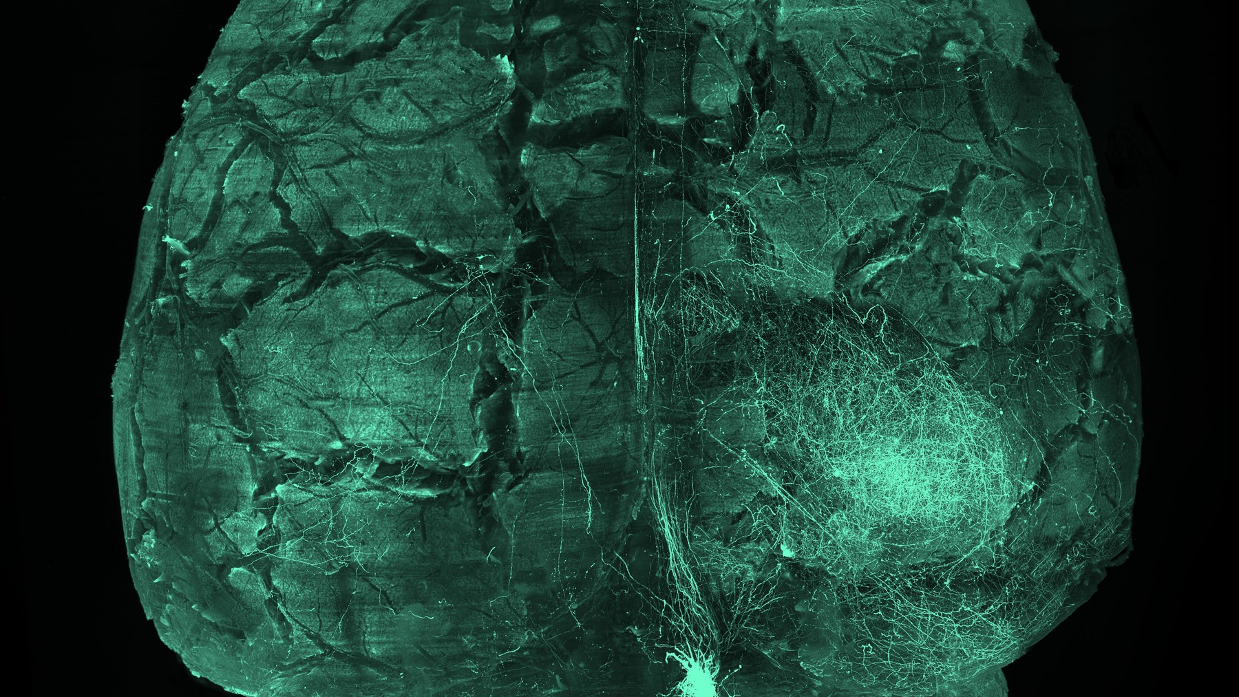 Cleared brain sample imaged for large-volume neural projection mapping