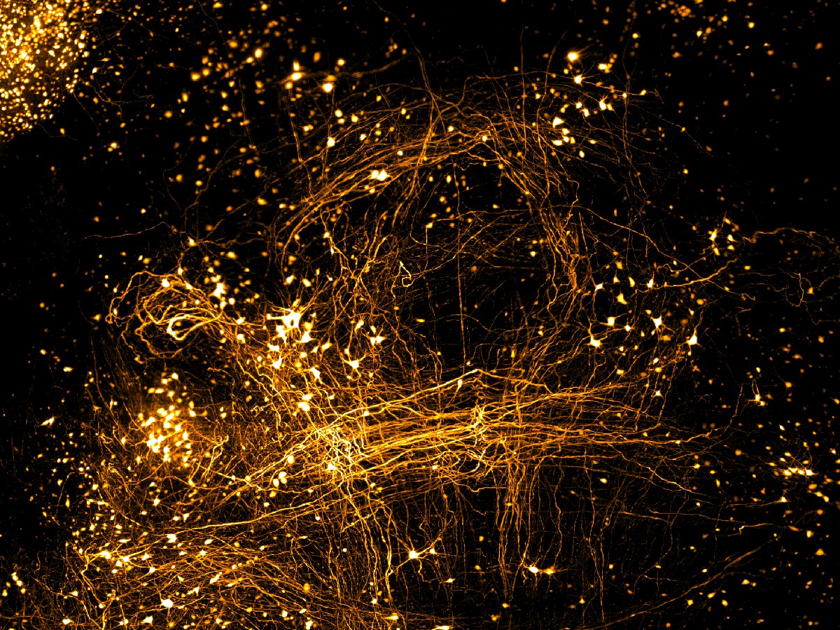 Dense orange neural labeling across a cleared tissue volume