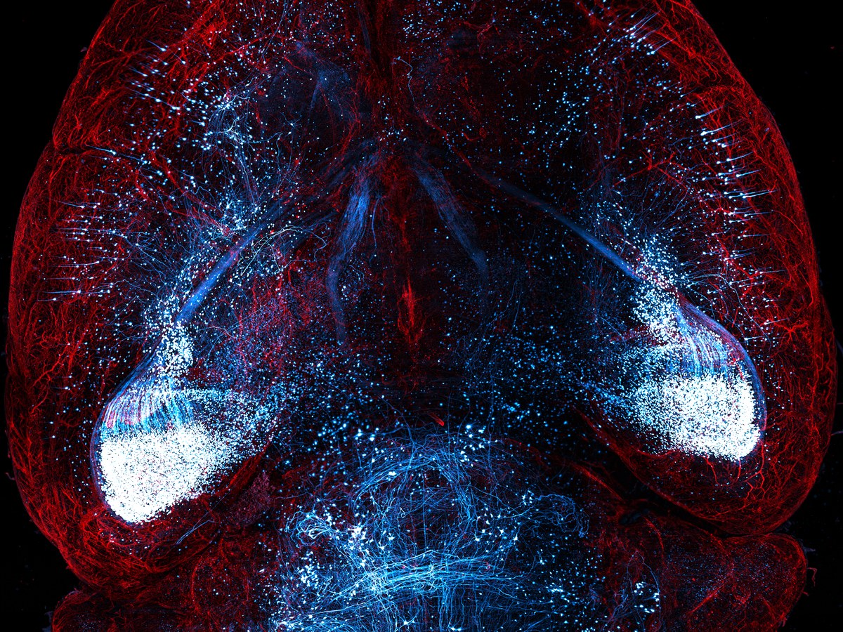 Red and cyan whole-brain microscopy image showing large-scale anatomical structure